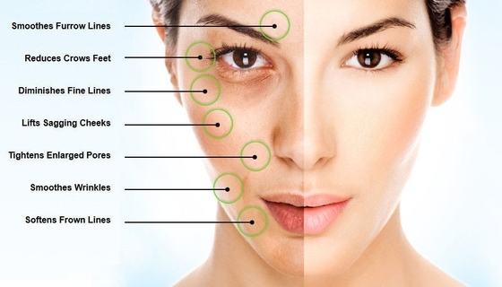 Pó ácido hialurónico do EINECS 232-678-0 pó de 2000 - de 5000 Dalton Pure Hyaluronic Acid Serum